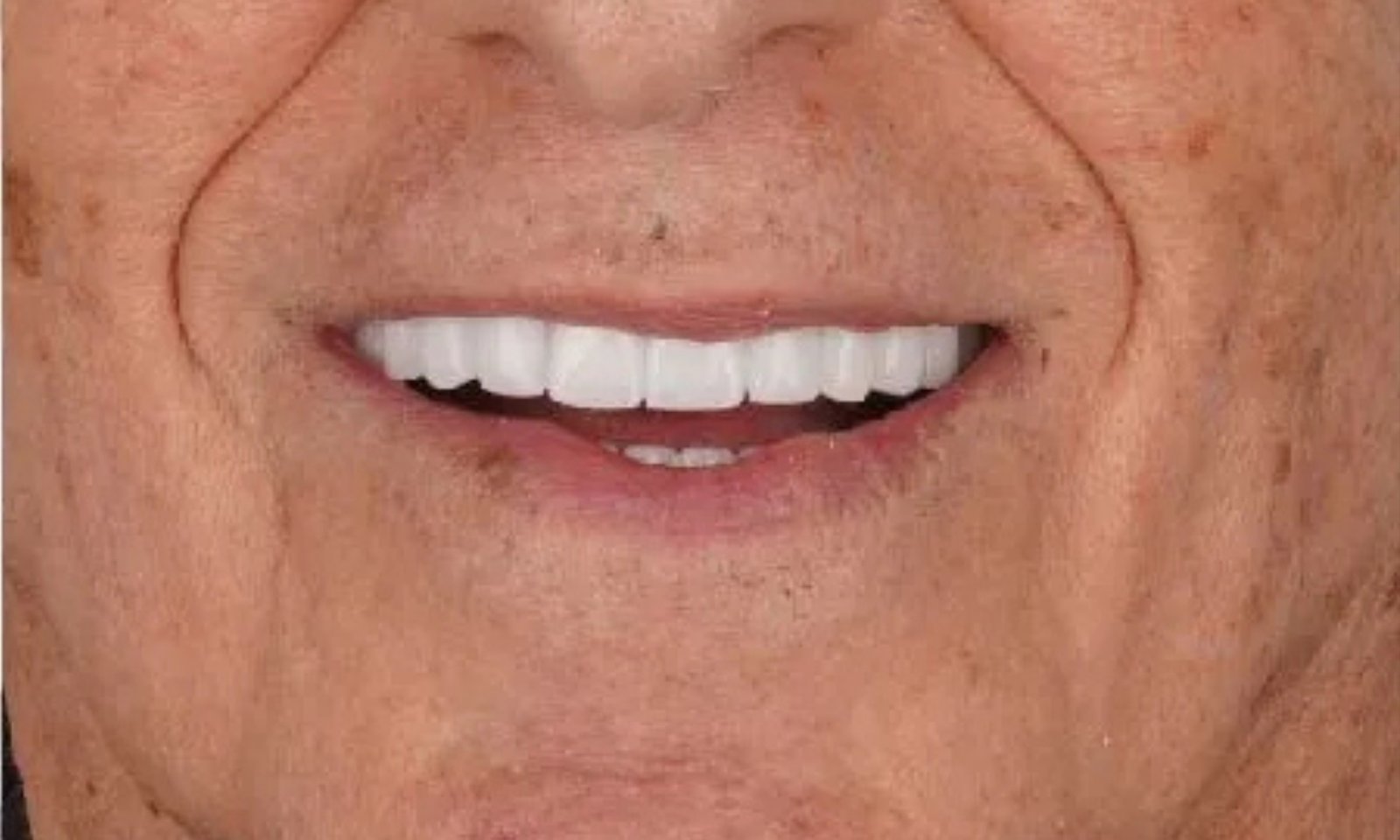 بعد 2