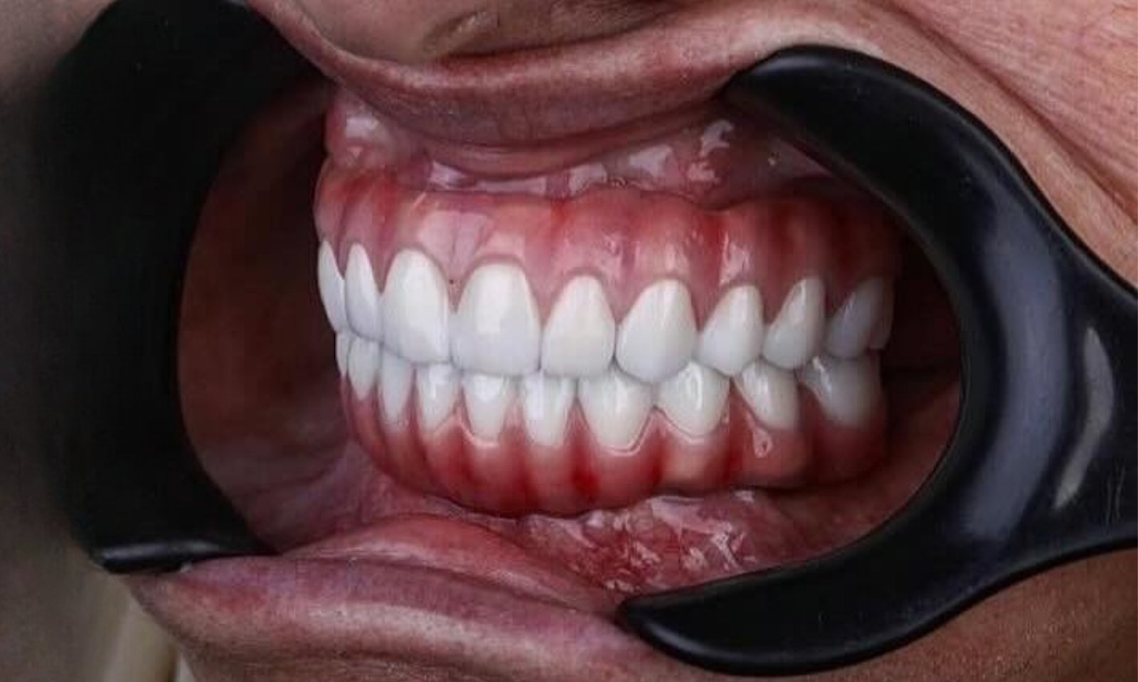 بعد 2