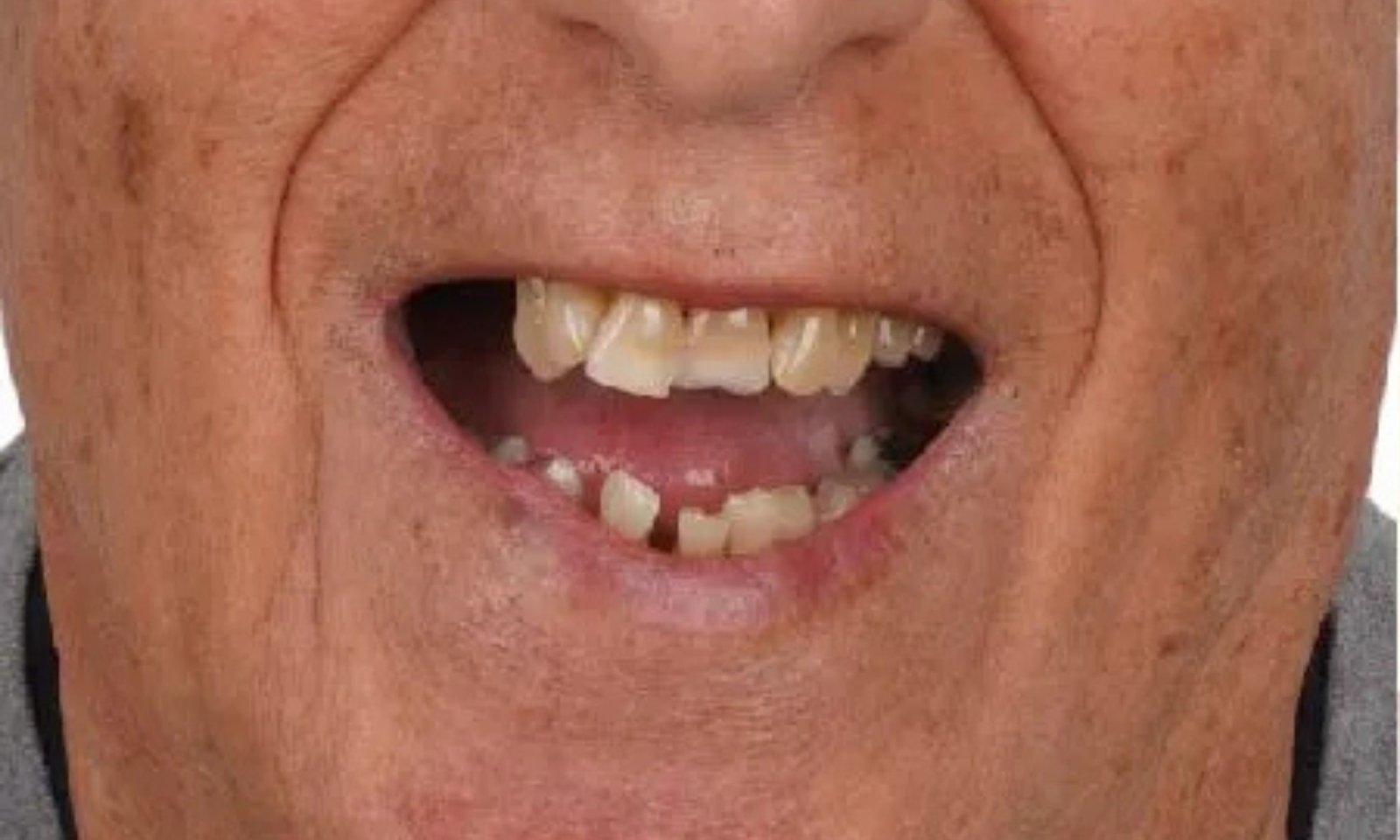 قبل 2